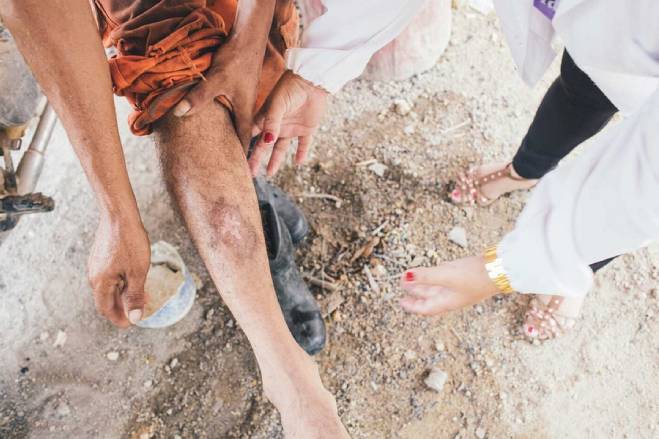 Leishmaniose cutânea predomina na Amazônia em áreas com desmatamento e pecuária.