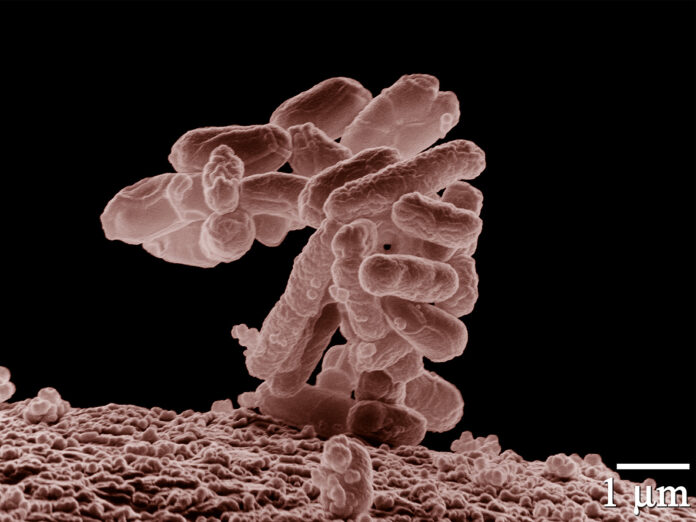 Escherichia coli no microscópio, ampliada 10.000 vezes. A bactéria foi modificada geneticamente e criou-se uma bactéria que transforma plástico em paracetamol.