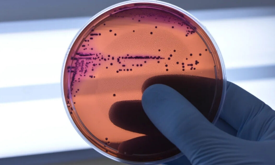 Imagem de cultura de bactérias em laboratório.