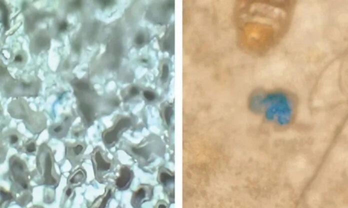 Imagem de microscopia mostra partícula de microplástico identificada em tecido humano de pulmão (esq.) e cérebro (dir.).