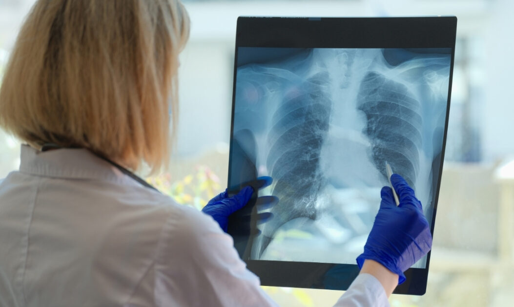 Médica analisa imagem de raio-X de pulmão, observando possíveis danos respiratórios relacionados a aumento de emissões de CO₂