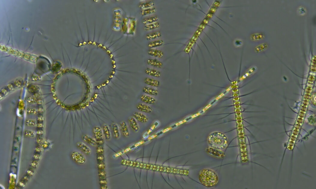 Micrografia de fitoplâncton do Ártico, mostrando algas unicelulares responsáveis pelos floramentos marinhos.