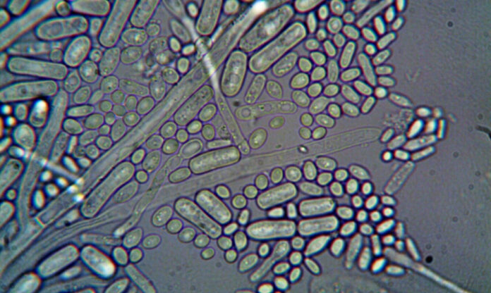 Imagem microscópica colorida de microrganismos, como bactérias e fungos, em diferentes formas e texturas.